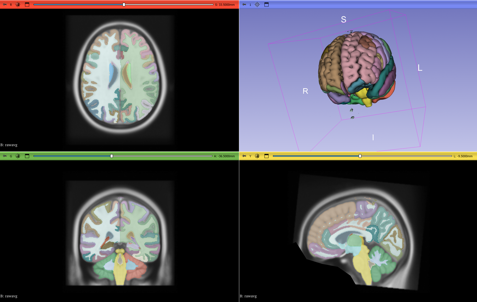 FastSurfer segmentation output FastSurfer output: deep-learning whole-brain segmentation and parcellation